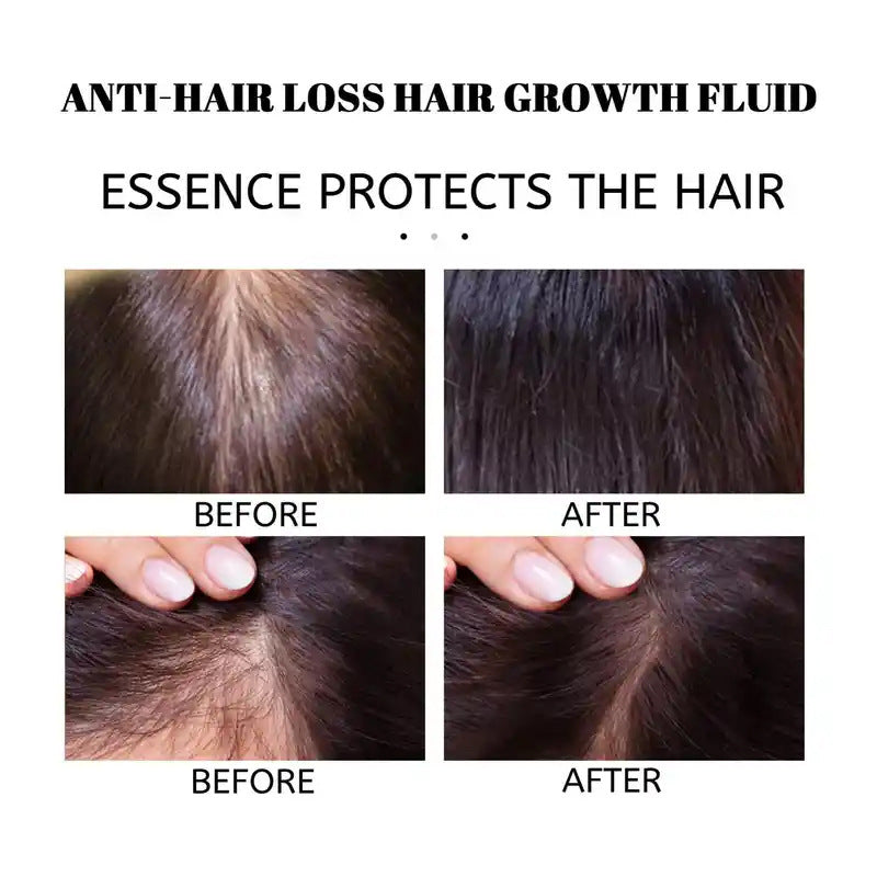 Rosemary Hair Oil